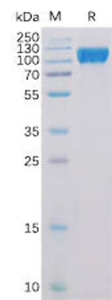 Human ACE2 Recombinant Protein His Tag HDPT0130