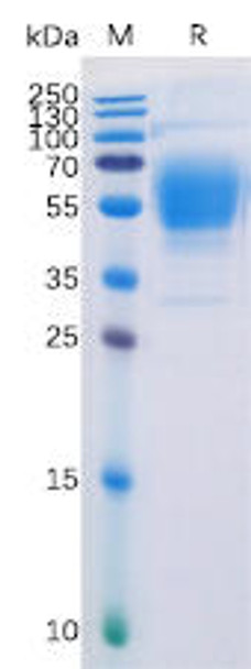 Human CB1 Recombinant Protein hFc Tag HDPT0132