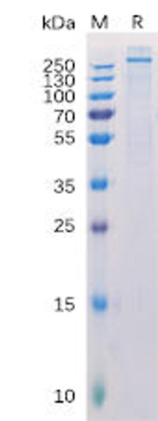 Human CSPG4 Recombinant Protein His Tag HDPT0140