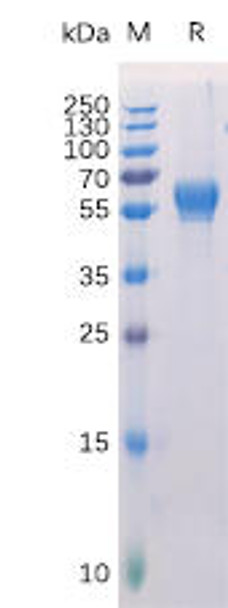 Human ROR1 Recombinant Protein His Tag HDPT0143