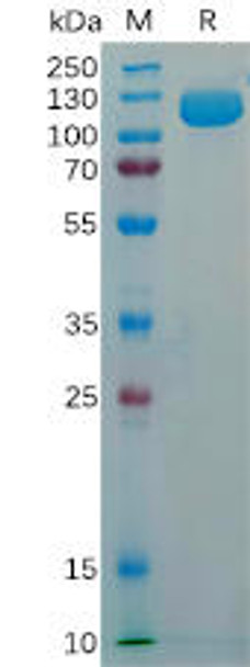 Human CD56 Recombinant Protein His Tag HDPT0167