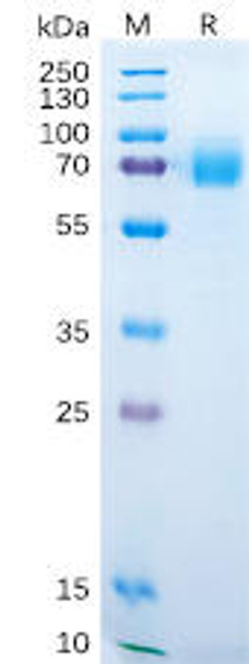 Human DKK1 Recombinant Protein hFc Tag HDPT0168