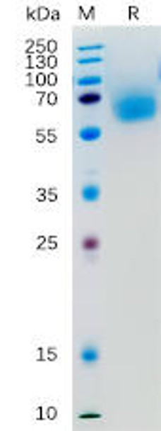 Human KLRG1 Recombinant Protein hFc Tag HDPT0170