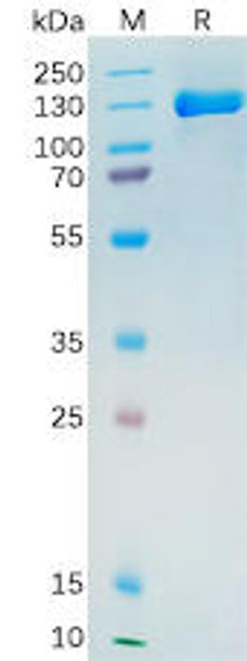 Human PSMA Recombinant Protein hFc Tag HDPT0171