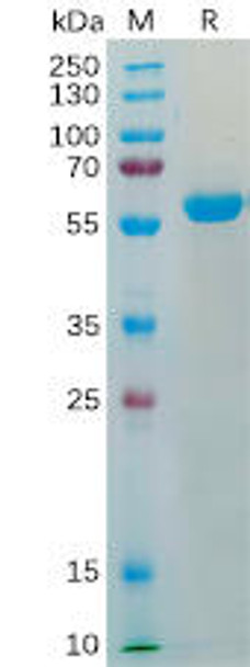 SARS-CoV-2 2019-nCoV S protein RBDK417N, E484K，N501Y, hFc Tag HDPT0186