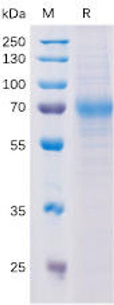 Human SLAMF3 Recombinant Protein His Tag HDPT0188