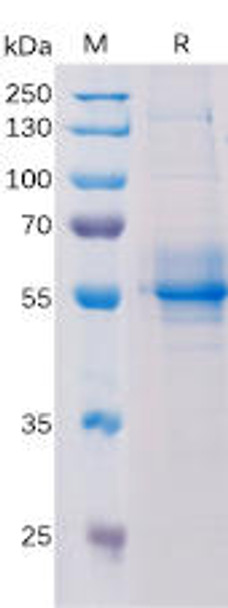 Human TMEM173 Recombinant Protein hFc Tag HDPT0189