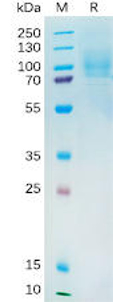 Human YAP1 Recombinant Protein His Tag HDPT0191