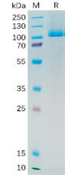 Human PSMA Recombinant Protein His Tag HDPT0192