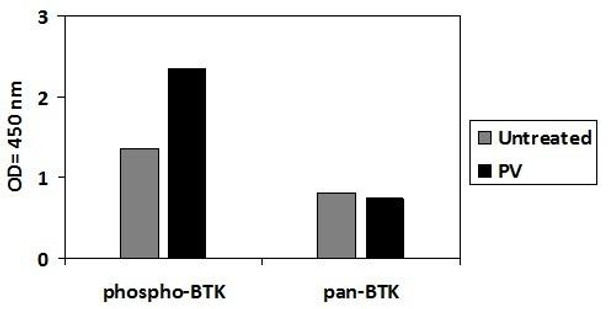 Human Phospho-BTK Y551 and Total BTK PharmaGenie ELISA Kit SBRS1767