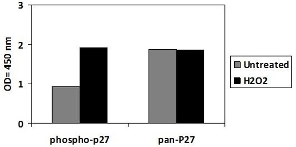 Human Phospho-P27/Kip1 T198 and Total P27/Kip1 PharmaGenie ELISA Kit SBRS1914