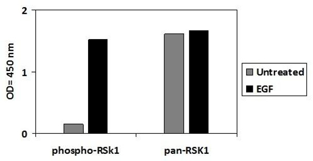 Human Phospho-RSK1 S380 PharmaGenie ELISA Kit SBRS1955