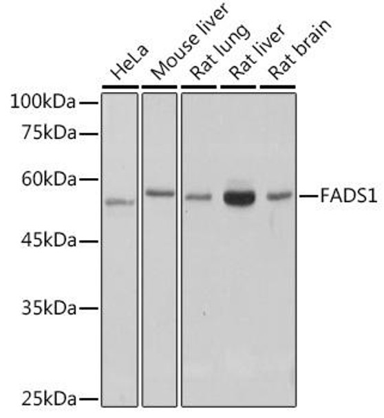 Anti-FADS1 Antibody CAB0178