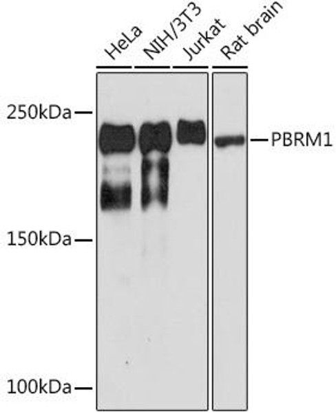 Anti-PBRM1 Antibody CAB0334
