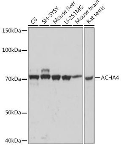 Anti-ACHA4 Antibody CAB0350