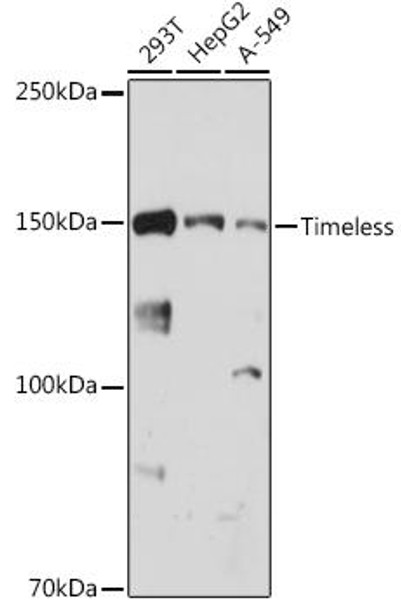 Anti-Timeless Antibody CAB0512