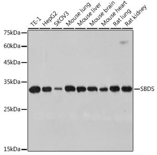 Anti-SBDS Antibody CAB0796