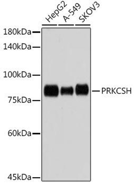 Anti-PRKCSH Antibody CAB0894