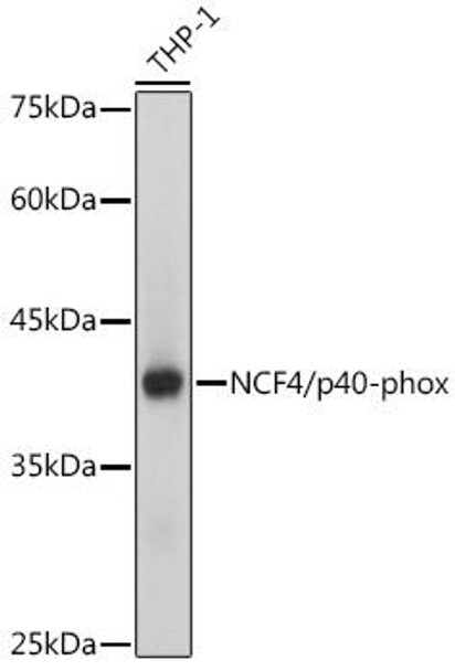 Anti-NCF4/p40-phox Antibody CAB0935