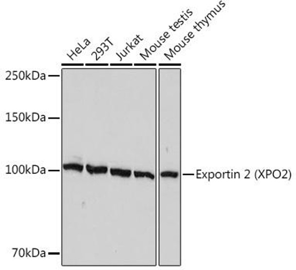 Anti-Exportin 2 XPO2 Antibody CAB1041