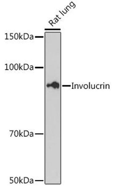 Anti-Involucrin Antibody CAB13311