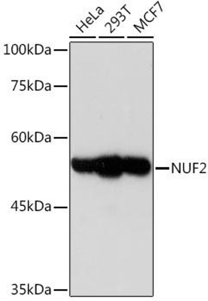 Anti-NUF2 Antibody CAB17553