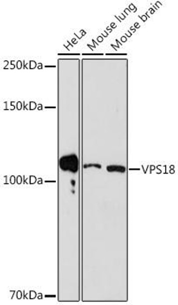 Anti-VPS18 Antibody CAB17563