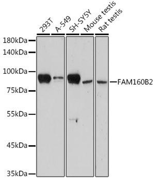 Anti-FAM160B2 Antibody CAB18835