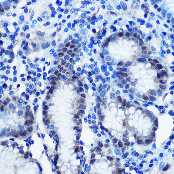 Anti-BRD4 Antibody CAB18840