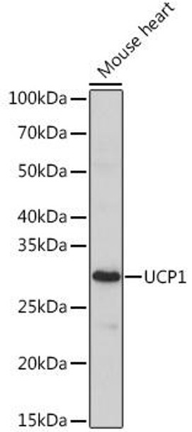 Anti-UCP1 Antibody CAB18853