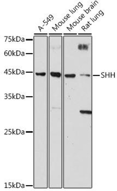 Anti-SHH Antibody CAB18863