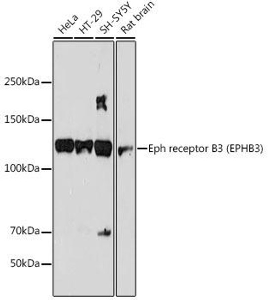 Anti-Eph receptor B3 EPHB3 Antibody CAB19229