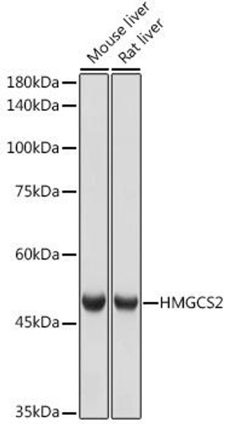 Anti-HMGCS2 Antibody CAB19232