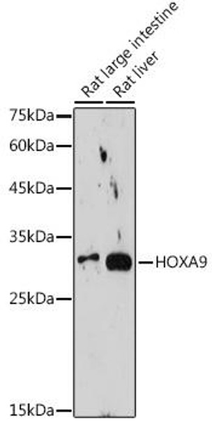 Anti-HOXA9 Antibody CAB19257