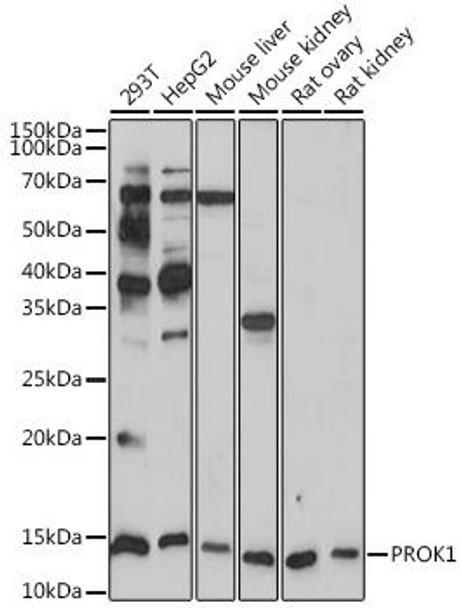 Anti-PROK1 Antibody CAB19268