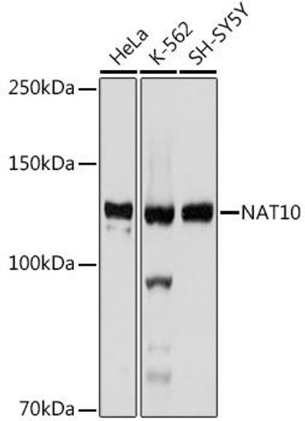 Anti-NAT10 Antibody CAB19286
