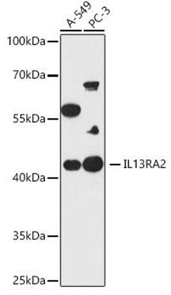 Anti-IL13RA2 Antibody CAB19318