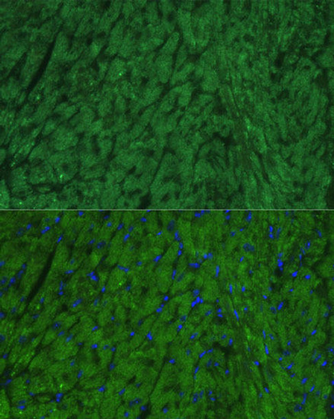 Anti-NPPA Antibody CAB19328