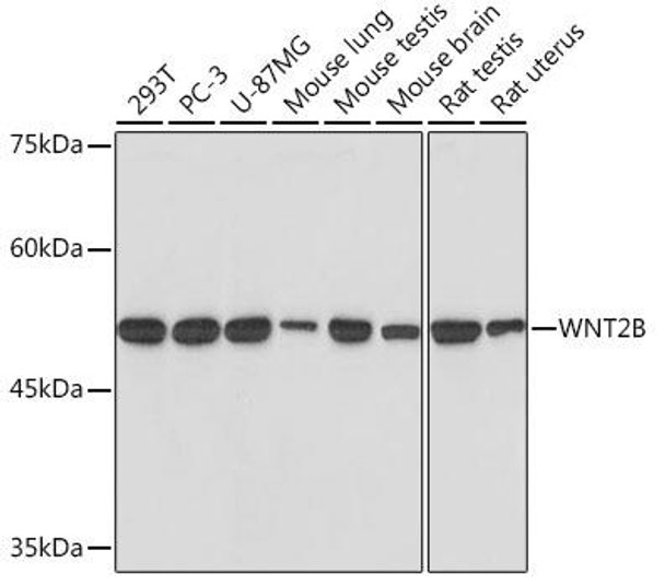 Anti-WNT2B Antibody CAB19554