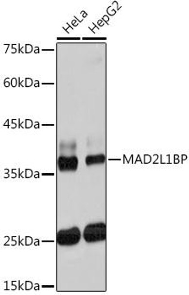Anti-MAD2L1BP Antibody CAB19600