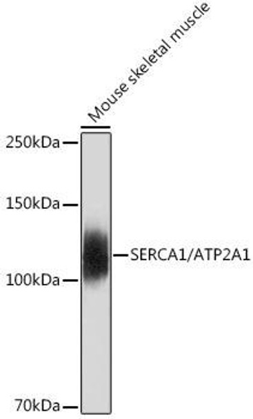 Anti-SERCA1/ATP2A1 Antibody CAB19639