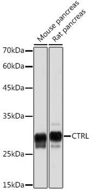 Anti-CTRL Antibody CAB19660