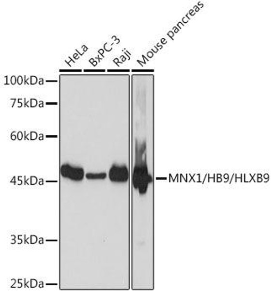 Anti-MNX1/HB9/HLXB9 Antibody CAB19690