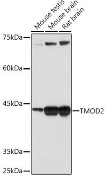 Anti-TMOD2 Antibody CAB19770