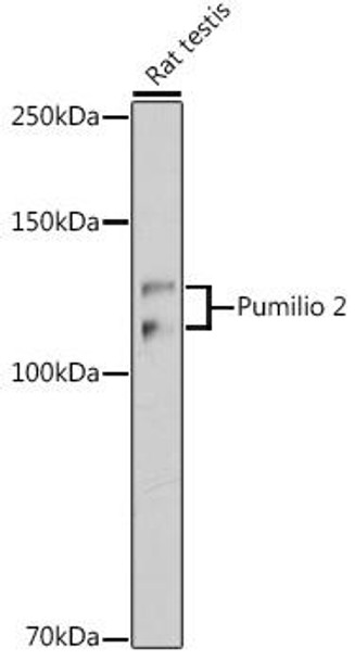 Anti-Pumilio 2 Antibody CAB19783