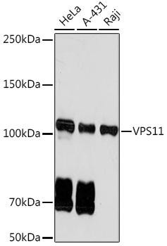 Anti-VPS11 Antibody CAB19798