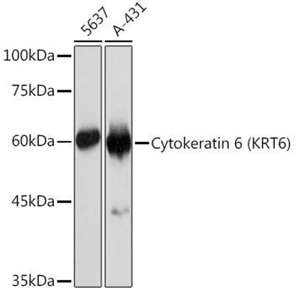 Anti-Cytokeratin 6 KRT6 Antibody CAB19827