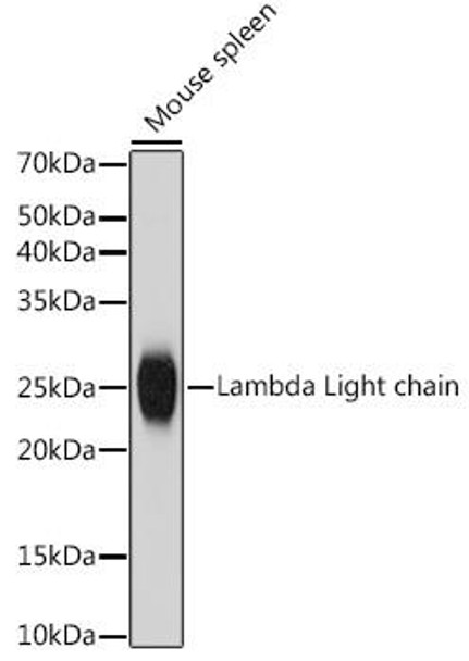 Anti-Lambda Light chain Antibody CAB19831
