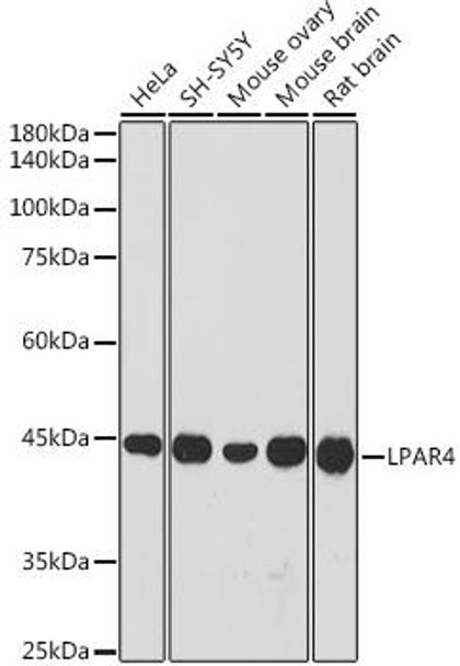 Anti-LPAR4 Antibody CAB20157