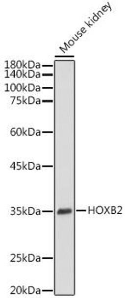 Anti-HOXB2 Antibody CAB20158